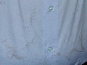 Holding a Chinchilla - The shirt of a veterinary surgeon after a chinchilla visit for a dental checkup.  Chinchilla Chronicles. Holding a Chinchilla - The shirt of a veterinary surgeon after a chinchilla visit for a dental checkup.  Chinchilla Chronicles.